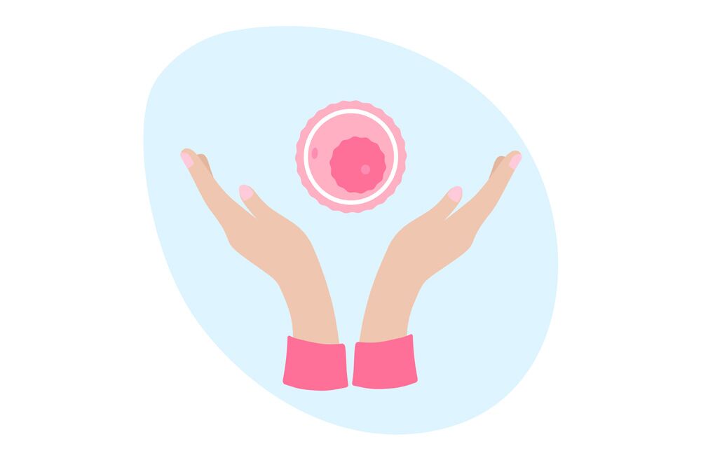 egg donation